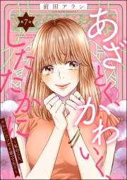 あざとく、かわいく、したたかに 〜私のこと、かわいいだけだと思ってた？〜（分冊版） 【第7話】